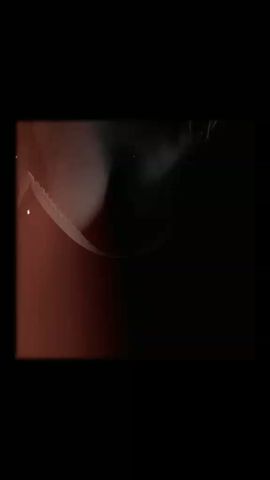 Lu 